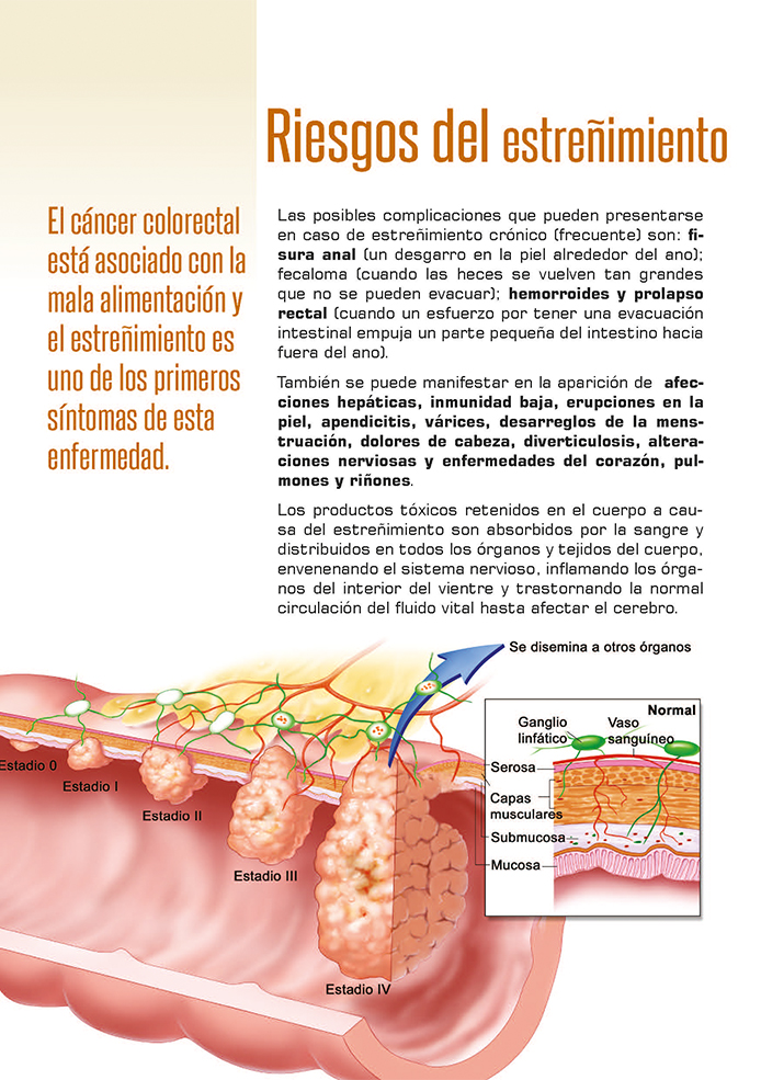 Revista Estreñimiento - Imagen 5